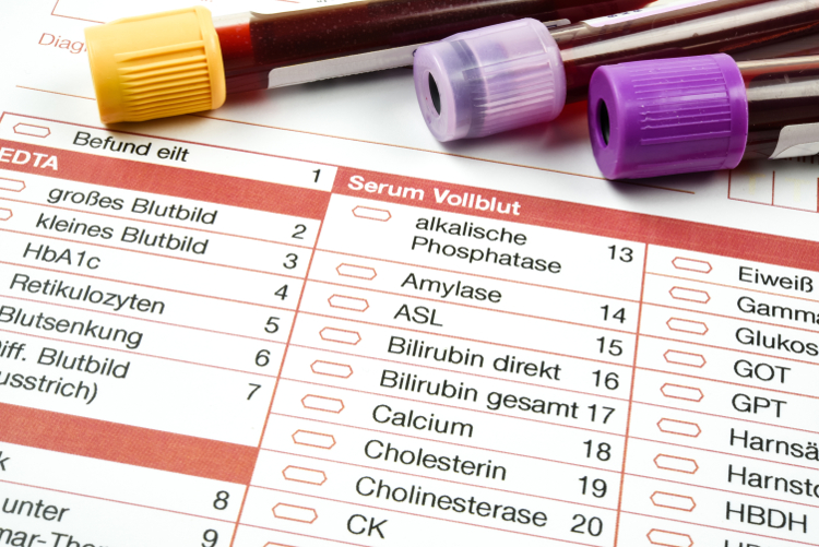 Allergietest machen - Meine Erfahrungen mit dem Testen auf Allergien